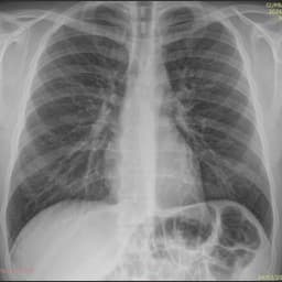 Vresh Aslan Ogli Zade